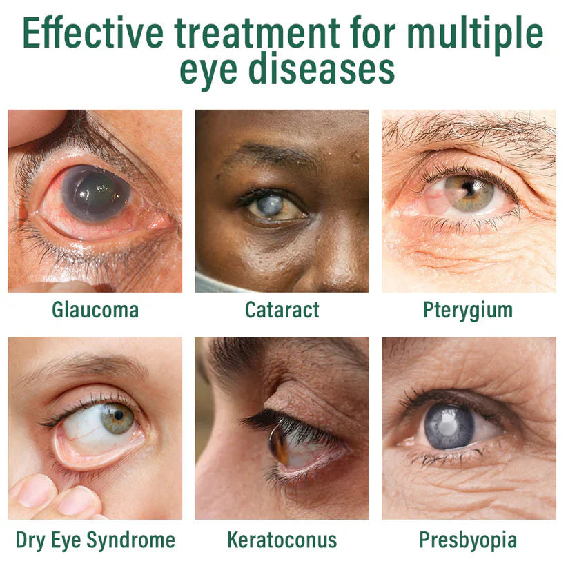 Nano Eye Drops Serum ✅FDA Approved(Suitable for presbyopia, dry eye syndrome, glaucoma, and cataracts) ☘️☘️