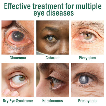 Nano Eye Drops Serum ✅FDA Approved(Suitable for presbyopia, dry eye syndrome, glaucoma, and cataracts) ☘️☘️