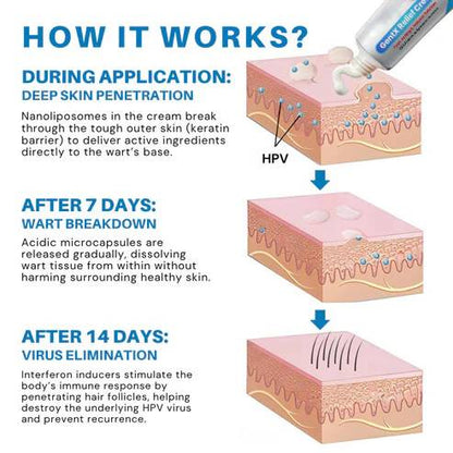 🌈🌞 Sale🌞🔥30 - Day Free Returns💰lirayn HPV Genital Warts Relief Cream🔥 - store